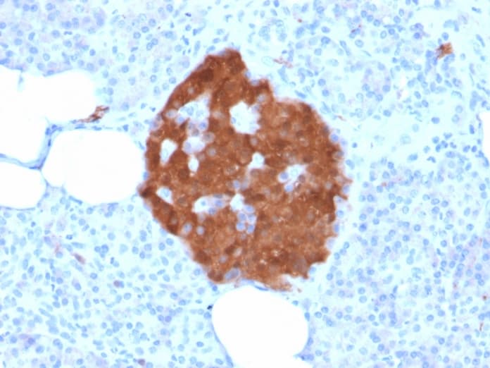UCHL1 / PGP9.5 Antibody (clone rUCHL1/775, Azide-free, Carrier-free)
