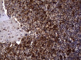 Monoclonal Mouse anti-Human TS / Thymidylate Synthase Antibody (clone 10F12, Carrier-free, IHC, WB)
