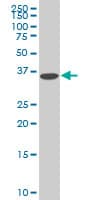 Monoclonal Mouse anti-Human DCPS Antibody (clone 1G4, IHC, IF, WB)