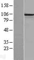 PCDHB6 Protein (Over-Expression Lysate Myc-DDK (Flag))