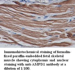 AMPD1 Antibody (Internal)
