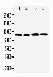 Polyclonal Rabbit anti-Human HMMR / CD168 / RHAMM Antibody (aa706-724, IHC, WB)