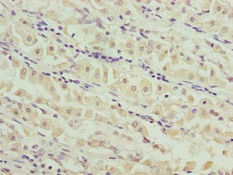GAJ / MND1 Antibody