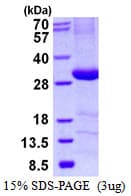 Human C4BPB / C4BP Beta Protein (Recombinant His)