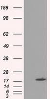 CRYAB / Alpha B Crystallin Antibody (clone OTI6G5)