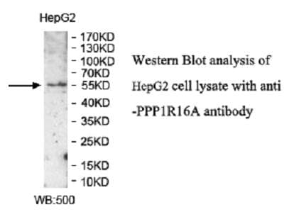 Polyclonal Rabbit anti-Human PPP1R16A Antibody (aa68-188, IHC, WB)
