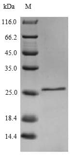 Mouse IL18 Protein (Recombinant 10His, N-terminus)