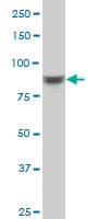 RPS6KA6 / RSK4 Antibody (clone 8E8)