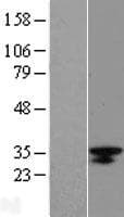 LRRC18 Protein (Over-Expression Lysate Myc-DDK (Flag))