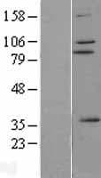 Human ZNF175 Protein (Over-Expression Lysate Myc-DDK (Flag))