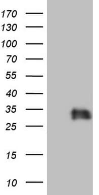 Adiponectin Antibody (aa19-244, clone OTI7G1)