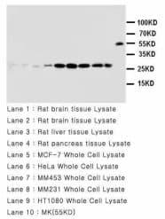 CCL2 / MCP1 Antibody (aa24-36)