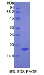 Human NPM1 / NPM / Nucleophosmin Protein (Recombinant His)