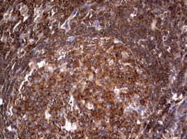 Hamartin / TSC1 Antibody (clone OTI5A8)