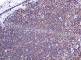 PIK3CG / PI3K Gamma Antibody (clone OTI4B1)