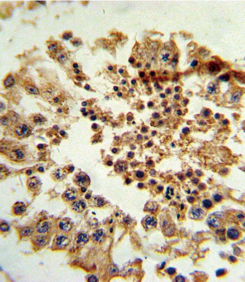 HNF4G / HNF4 Gamma Antibody (aa70-100)