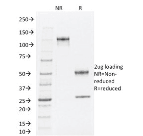 Monoclonal Mouse anti-Human TLE1 / TLE 1 Antibody (clone TLE1/2062, IHC, WB)