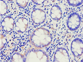 Polyclonal Rabbit anti-Human ABCE1 Antibody (aa320-599, IHC, WB)
