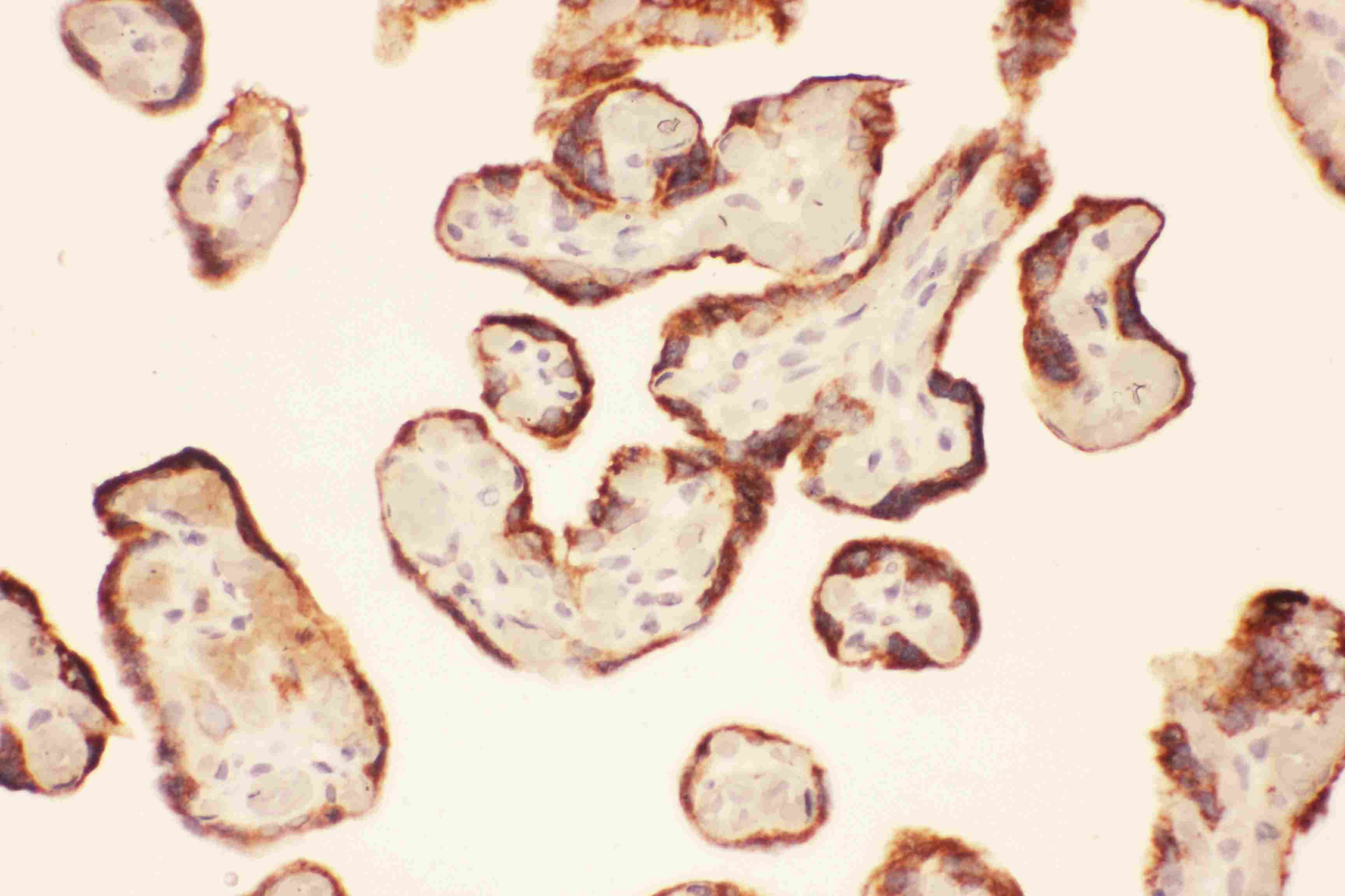 LIF Antibody (aa23-202)