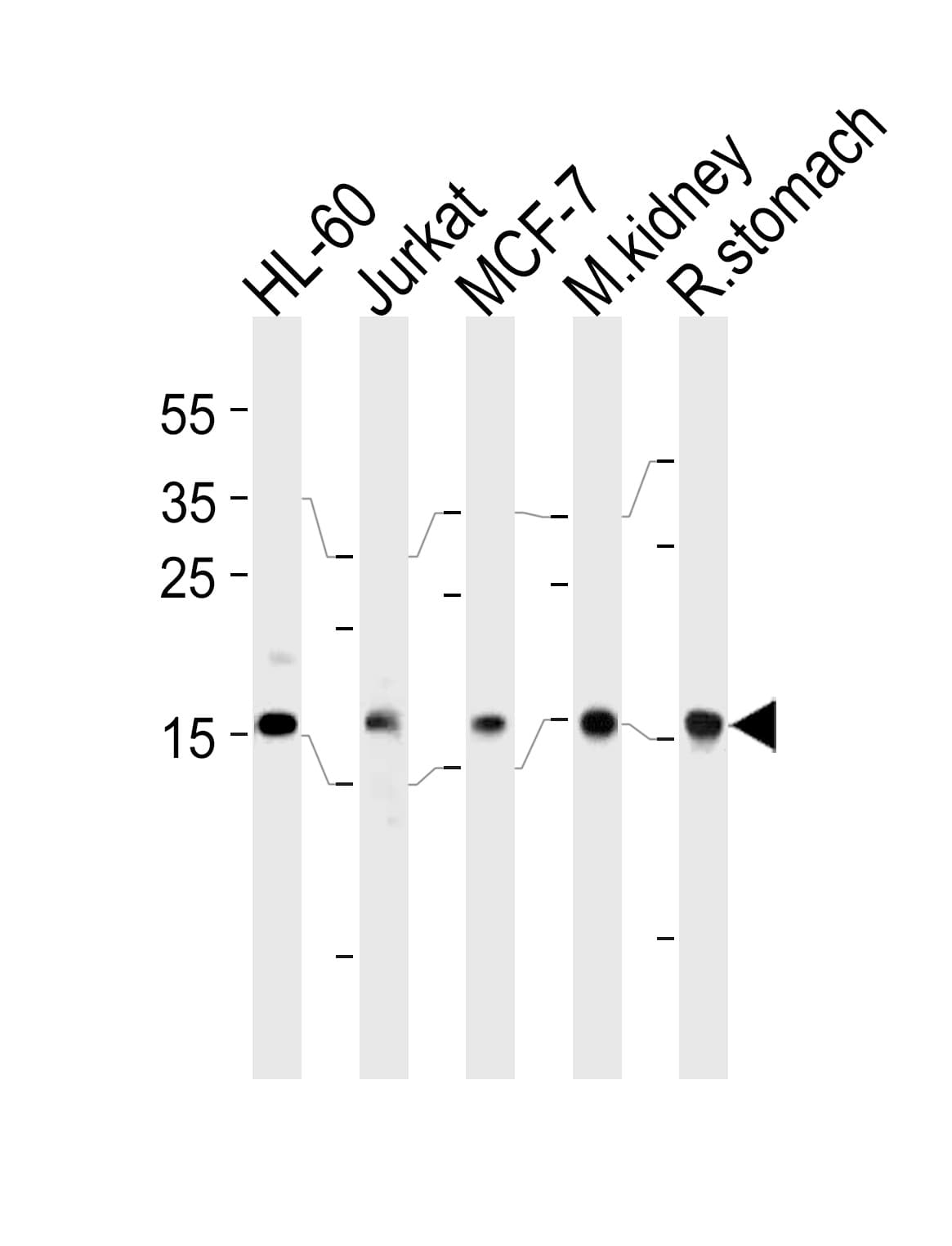 NME2 Antibody (aa25-54)