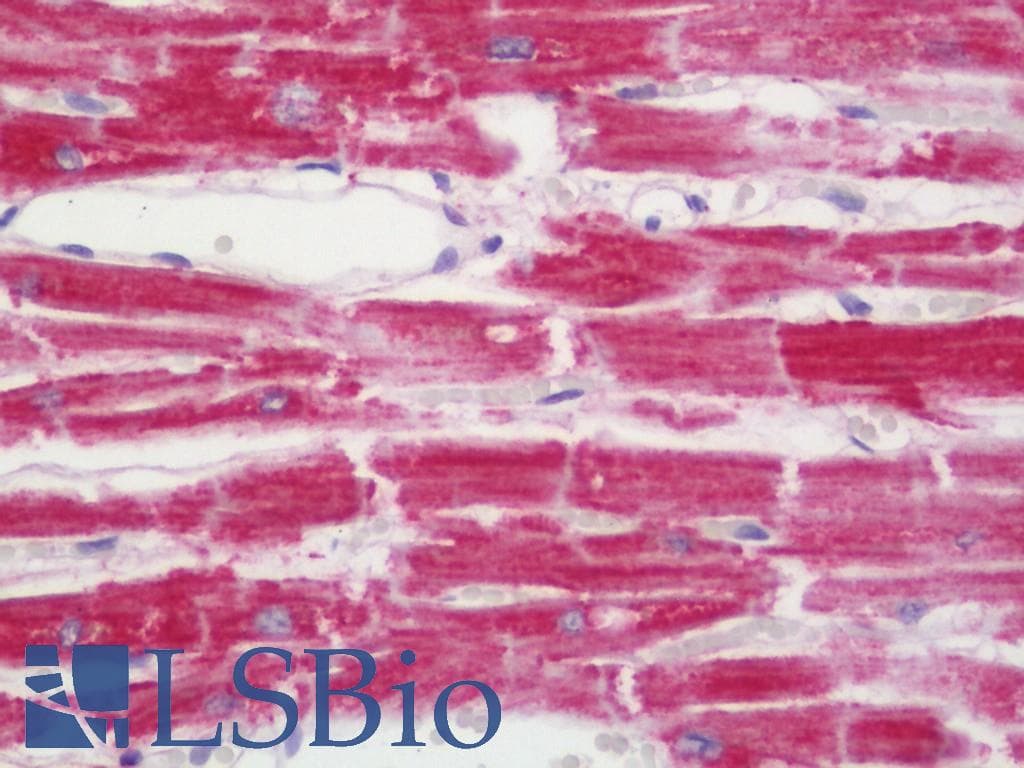 IHC-plus™ Polyclonal Rabbit anti-Human MAOA / Monoamine Oxidase Antibody (aa298-347, IHC, WB)