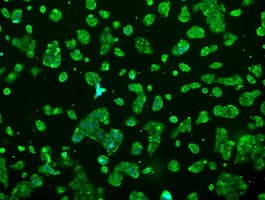 PRL / Prolactin Antibody (clone OTI6B1, Carrier-free)