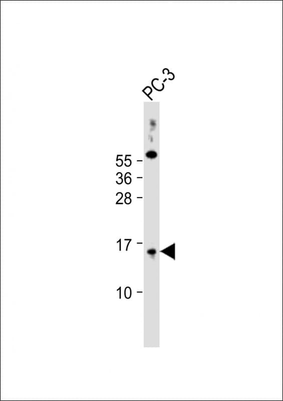 Polyclonal Rabbit anti-Human SYNJ2BP / OMP25 Antibody (N-Terminus, WB)