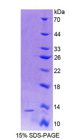 Rat GC / Vitamin D-Binding Protein (Recombinant His)