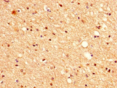 Vasohibin 1 / VASH1 Antibody (aa1-204)