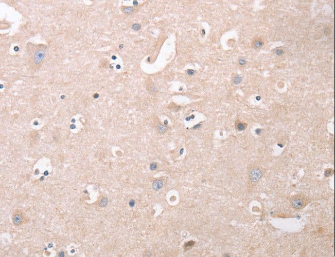 CDCA4 Antibody