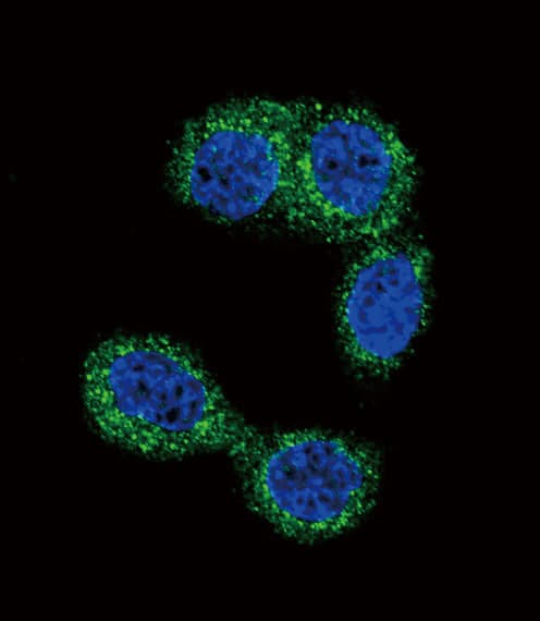 HMT / HNMT Antibody (aa29-58)