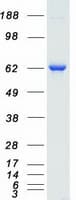 Human RPS6KB1 / P70S6K / S6K Protein (Recombinant Myc-DDK (Flag))