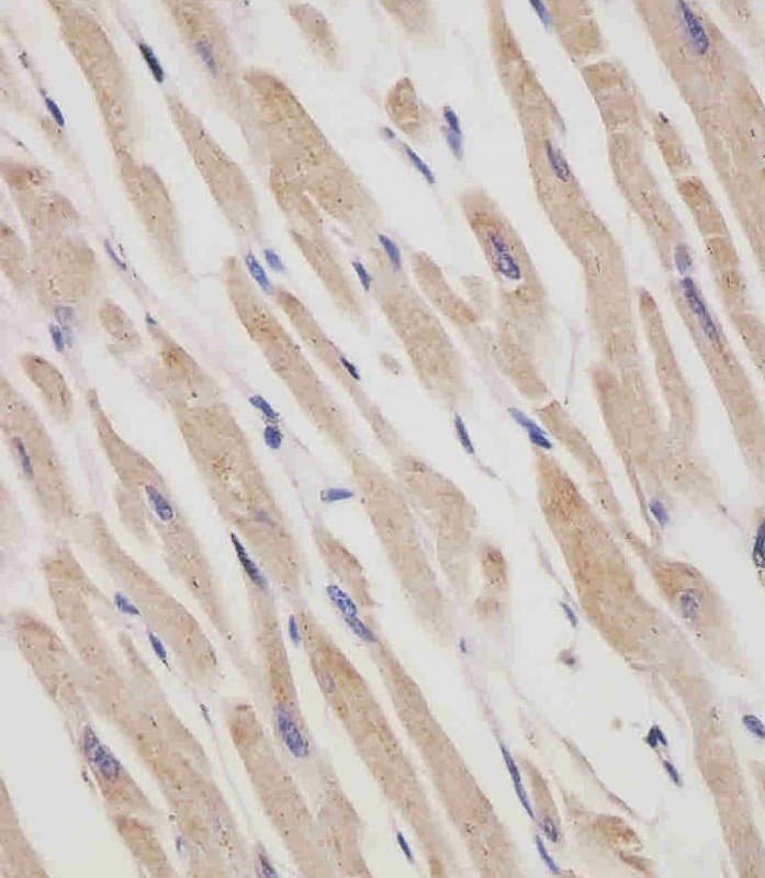 Monoclonal Mouse anti-Human RANBPM Antibody (clone 1815CT202.22.8.37, IHC, WB)
