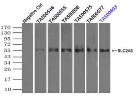 SLC2A5 / GLUT5 Antibody (clone OTI14C8)