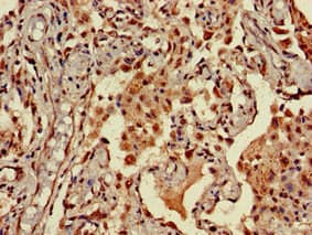 Polyclonal Rabbit anti-Human NINJ1 / Ninjurin Antibody