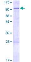 Human CYP11B1 Protein (Recombinant GST)