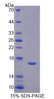 Human FADS3 Protein (Recombinant His-T7)