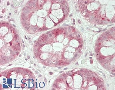 IHC-plus™ Polyclonal Rabbit anti-Human NOL5A / NOP56 Antibody (aa494-544, IHC, WB)