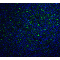 IL17A Antibody