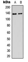 DHX8 Antibody (Internal)