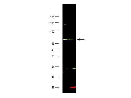 IHC-plus™ FANCG Antibody (aa1-25)