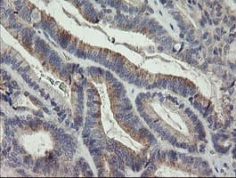 Monoclonal Mouse anti-Human P3H1 / LEPRE1 Antibody (clone OTI1A1, IHC, WB)