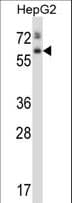 Polyclonal Rabbit anti-Human ASPG Antibody (aa165-193, WB)