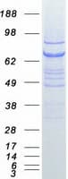 Human VPS33B Protein (Recombinant Myc-DDK (Flag))