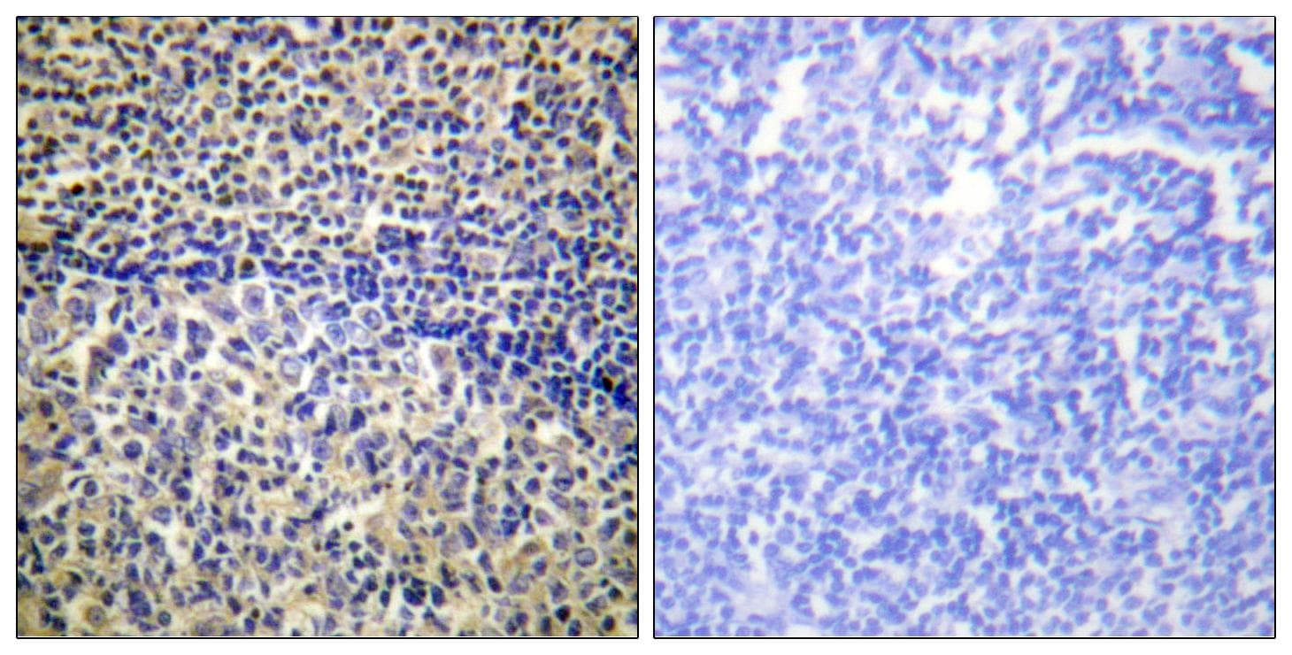 Polyclonal Rabbit anti-Human NCF1 / p47phox / p47 phox Antibody (Ab-328, IHC, IF)