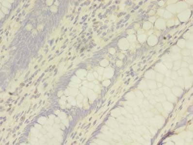 Polyclonal Rabbit anti-Human ADAM10 Antibody (IHC)