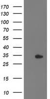 HDHD2 Antibody (clone OTI5C5)