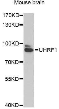 UHRF1 Antibody