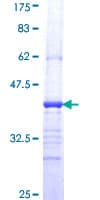 Human FZD8 / Frizzled 8 Protein (Recombinant GST, N-terminus)