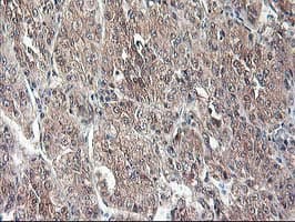 ALS2CR1 / NIF3L1 Antibody (clone OTI1F6)